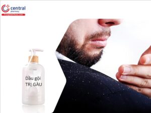 8 Loại Dầu Gội Trị Gàu Hiệu Quả Được Ưa Chuộng Nhất