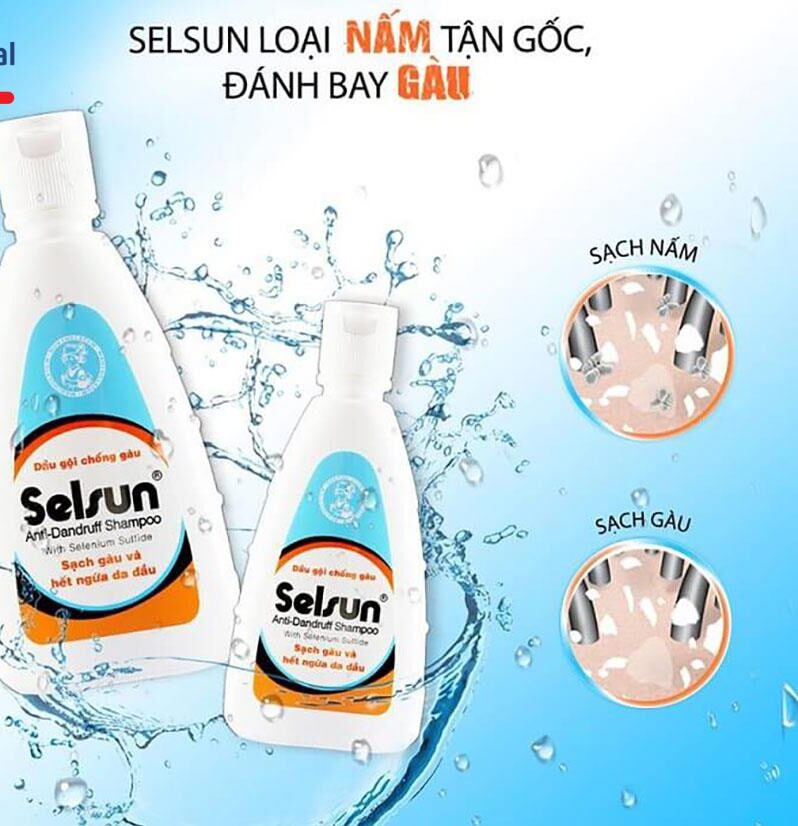 Dầu gội trị gàu Selsun Anti-Dandruff Shampoo